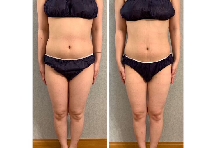 9CB9BFC8-EAD2-4AC5-B017-3E68B4157EE3